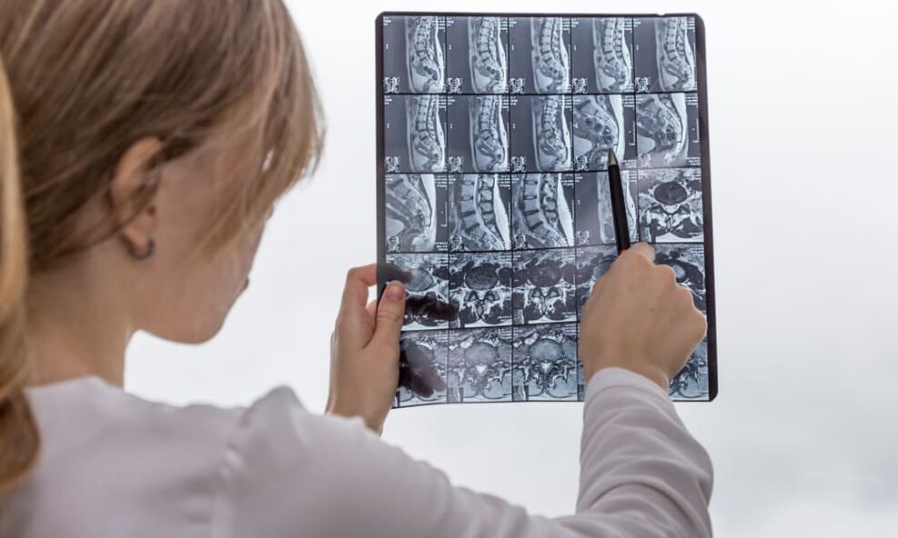 Magnetic resonance imaging will help doctors identify osteoarthritis and prescribe treatment