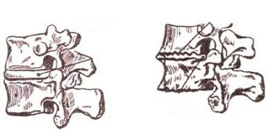 The stage of development of cervical bone