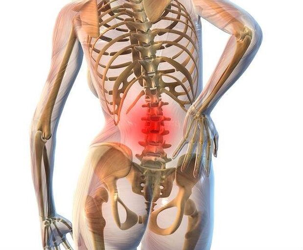 Lumbar spine degeneration