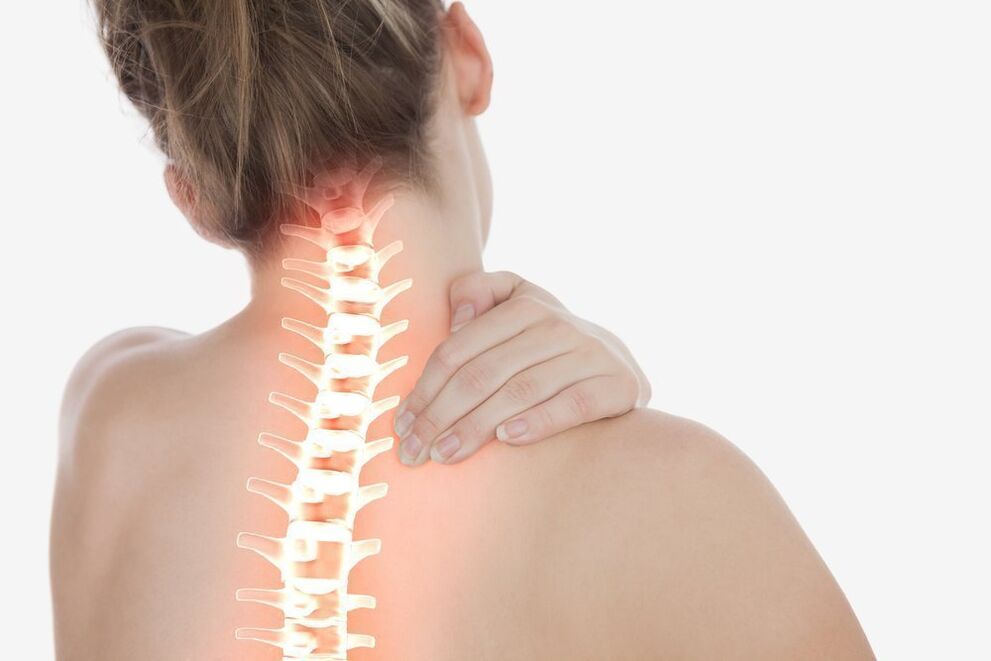 Cervical spondylosis and treatment with exercises