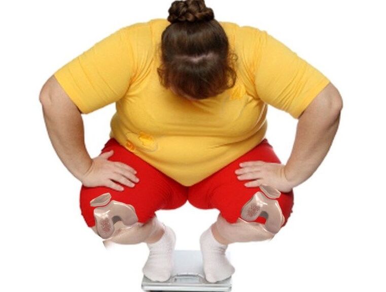 Among patients with joint disease, the majority are overweight or obese