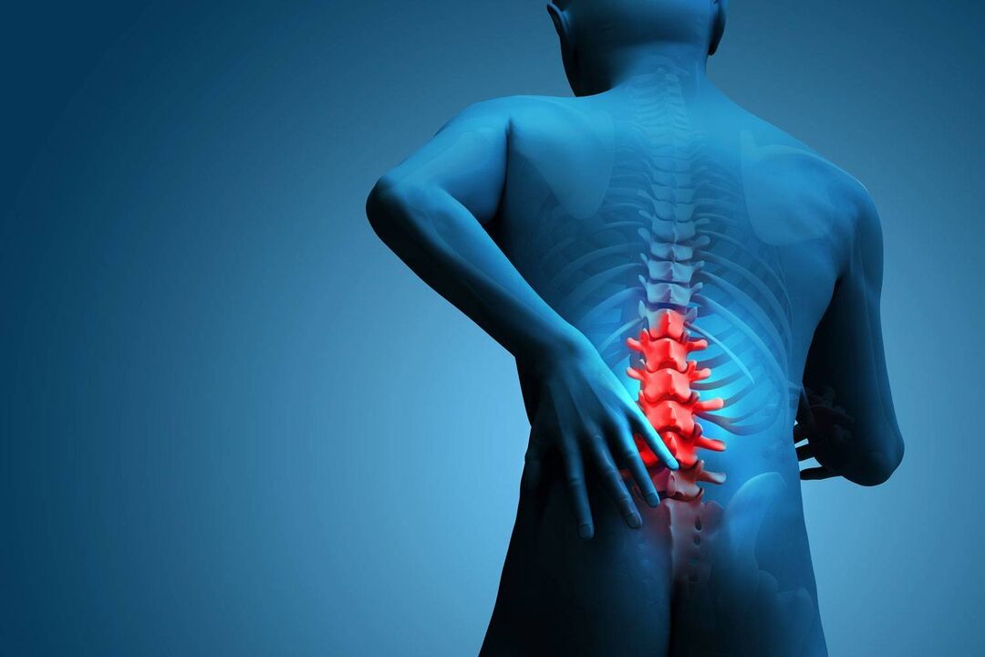 pain due to lumbar osteoarthritis